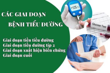 cac-giai-doan-benh-tieu-duong