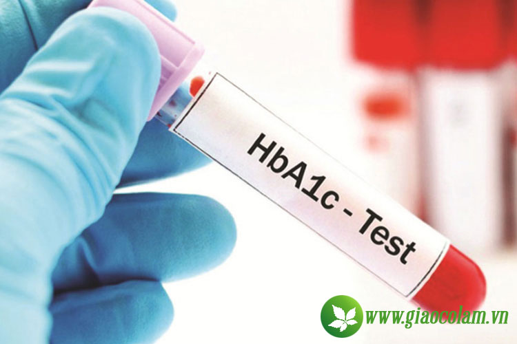 xet-nghiem-HbA1c