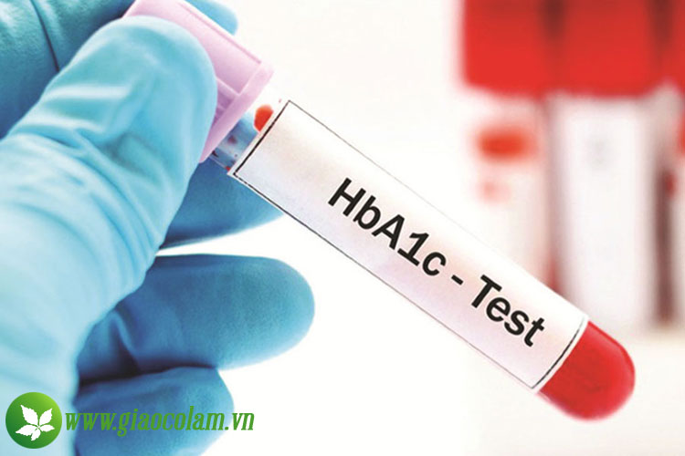 theo-doi-chi-so-hba1c